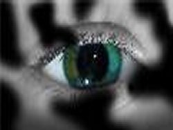 Diabetic retinal screening Diabetic retinal screening
